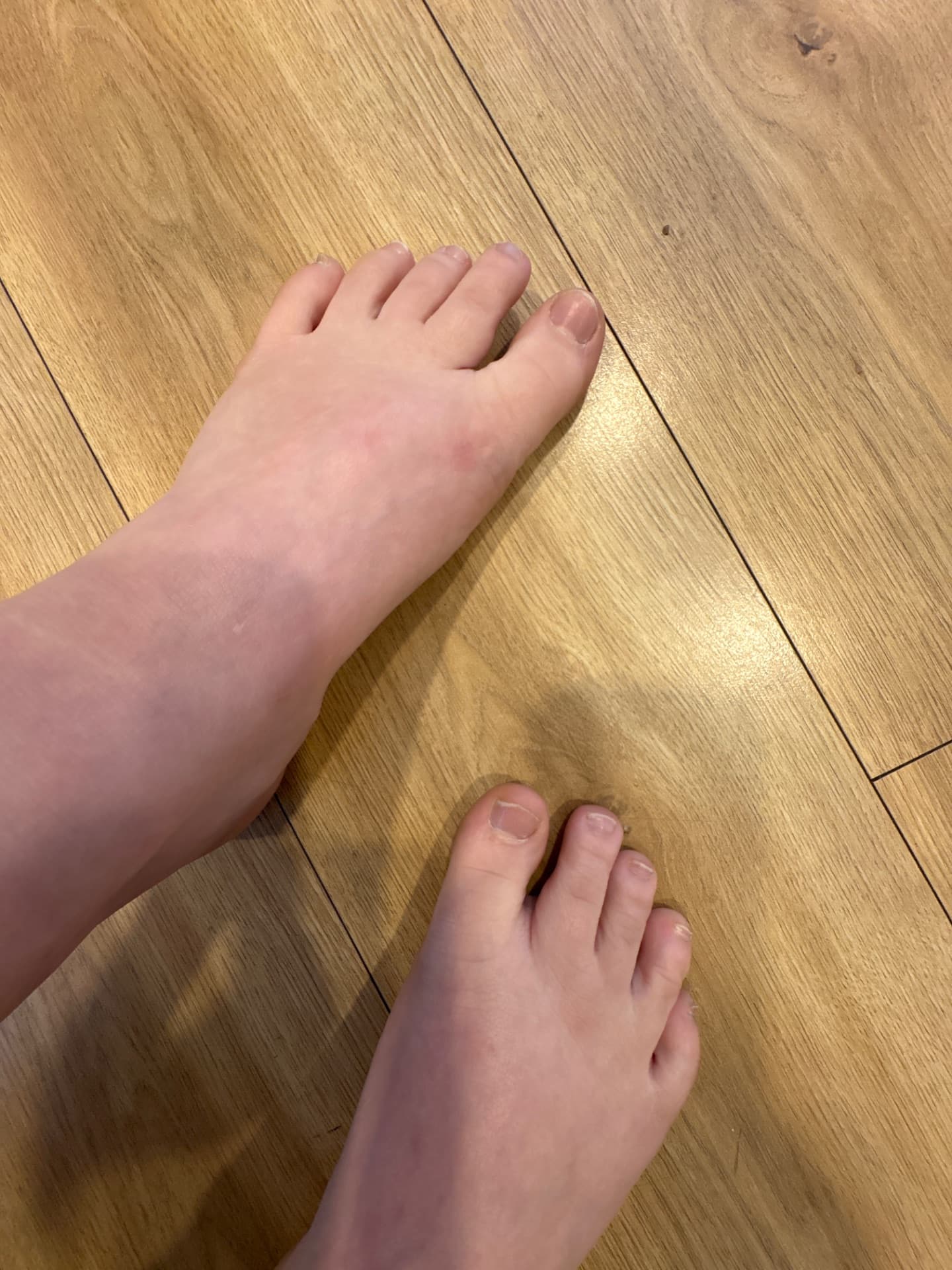 Nursefeet385 content