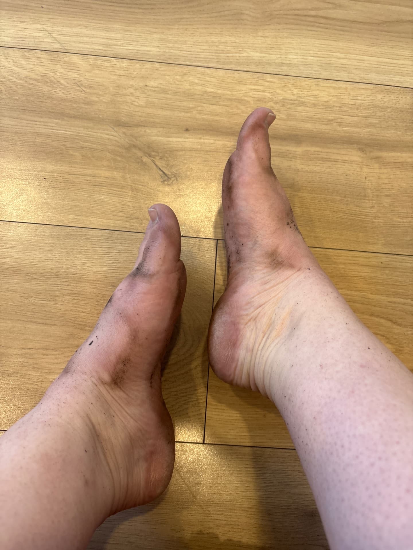 Nursefeet385 content