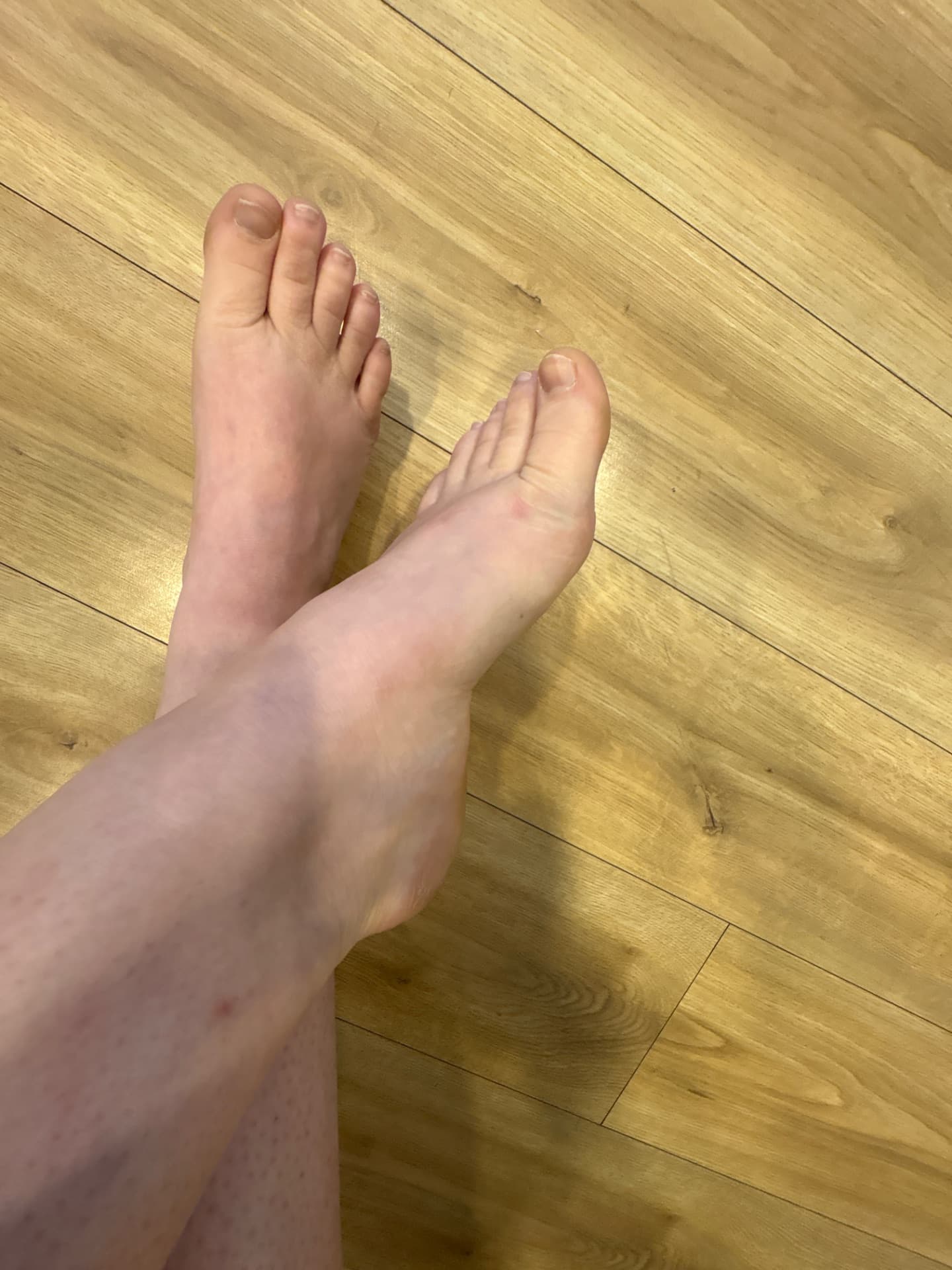 Nursefeet385 content