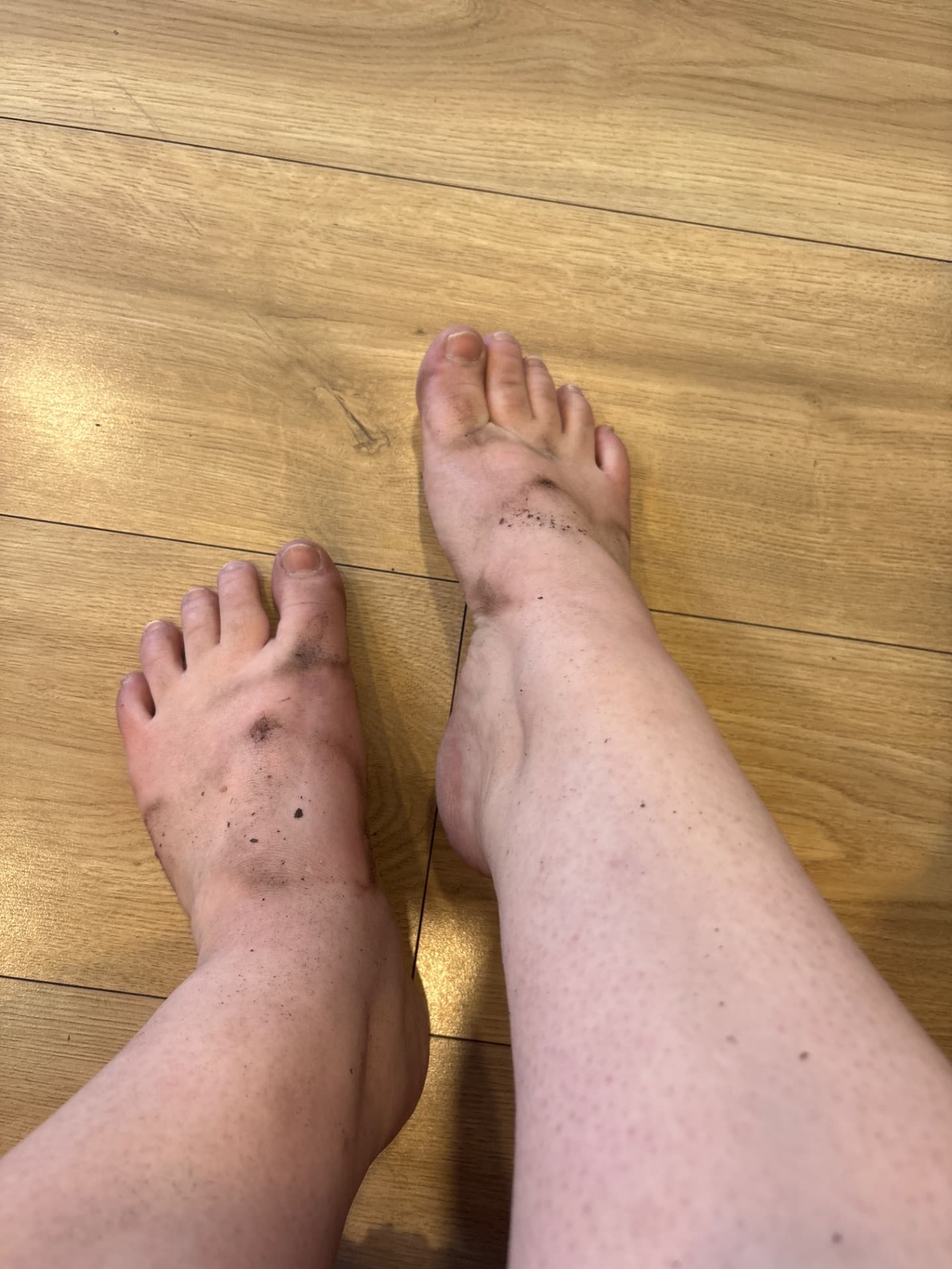 Nursefeet385 content